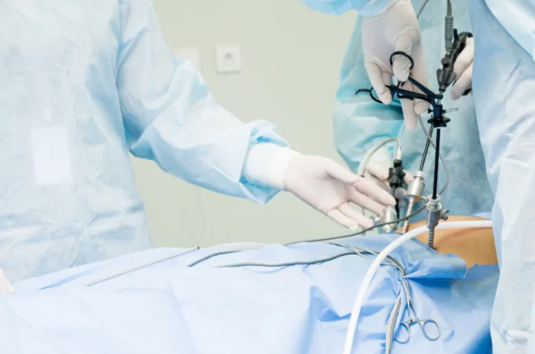 Laparoskopická operace pro léčbu refluxu jícnu