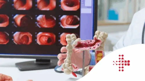 Gastroenterologické vyšetření s endoskopickými snímky na obrazovce.